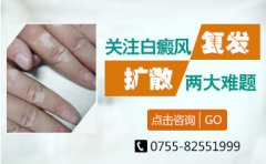<b>广东深圳哪家是白癜风医院？多年白癜风疾病有复色可能吗</b>